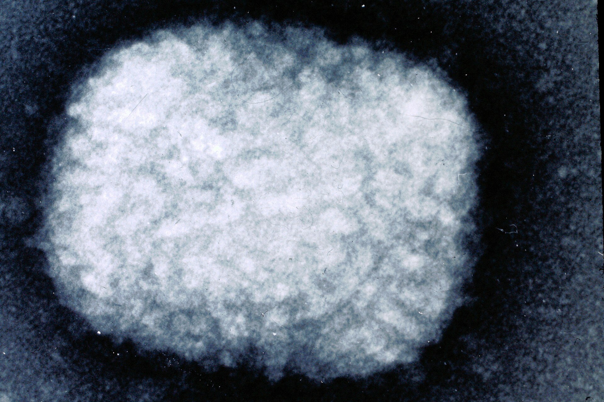 天花病毒（Variola virus）电子显微镜照片